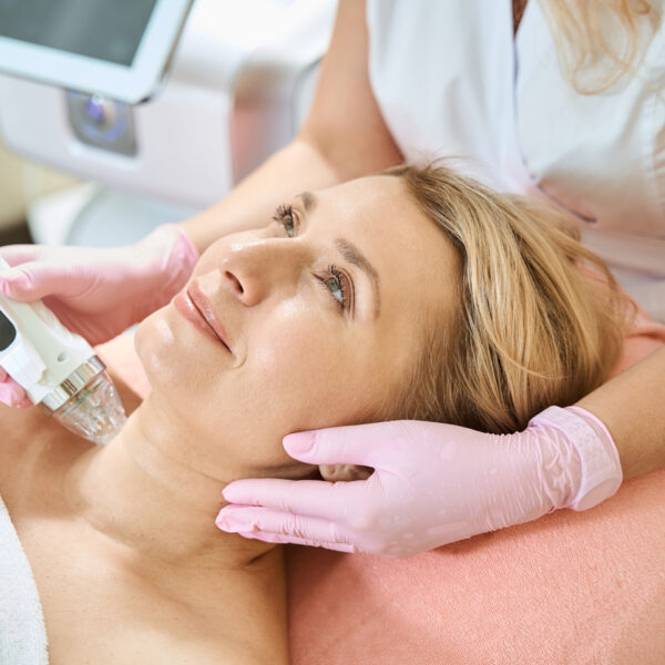Cursus microneedling RF