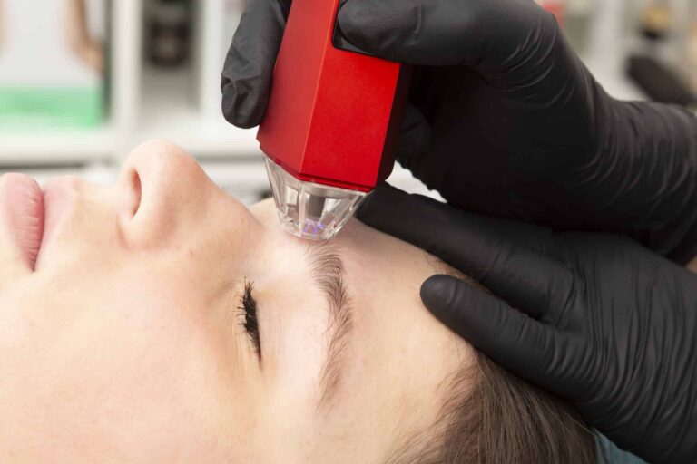 Cursus Cold Plasma Gezichtsbehandeling