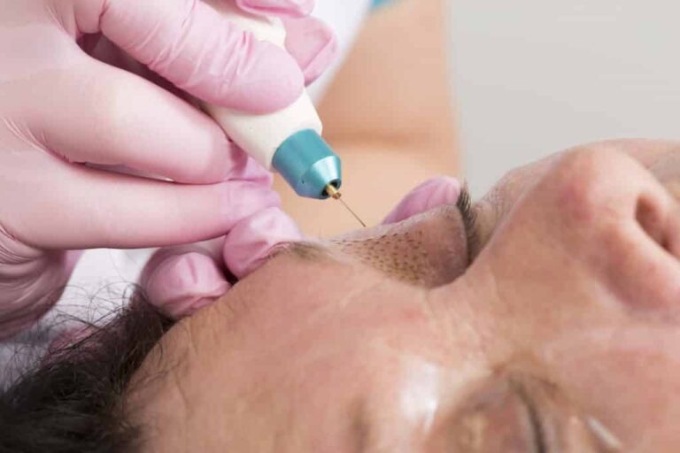 Cursus Fibroblasting Plasma Lift