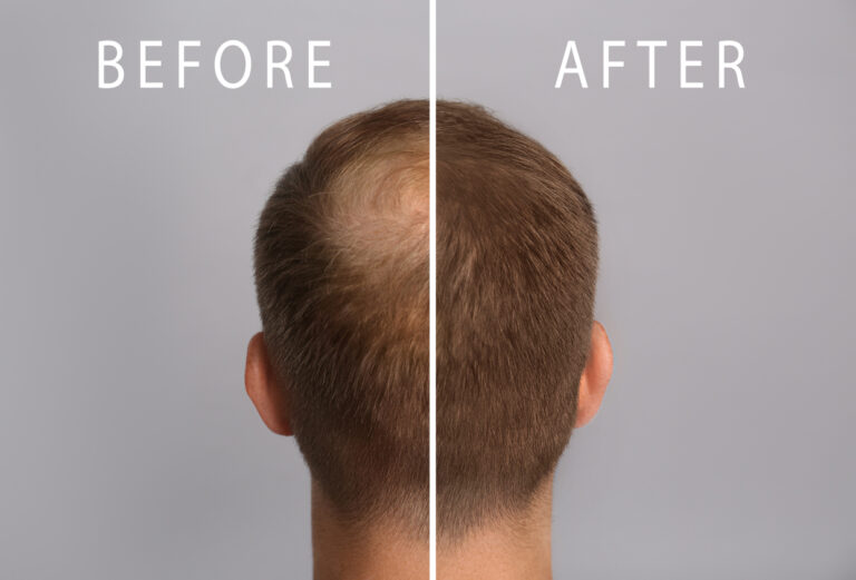 Cursus haarbooster
