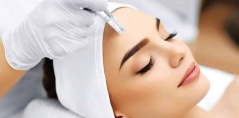 Cursus microneedling