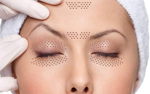 Online Cursus Fibroblasting