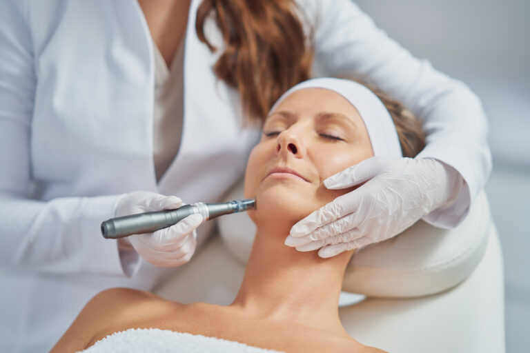 Praktijktraining Microneedling
