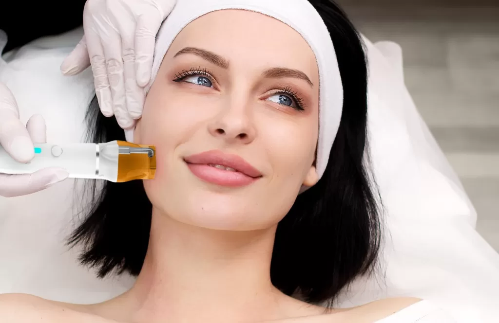 RF microneedling star 13